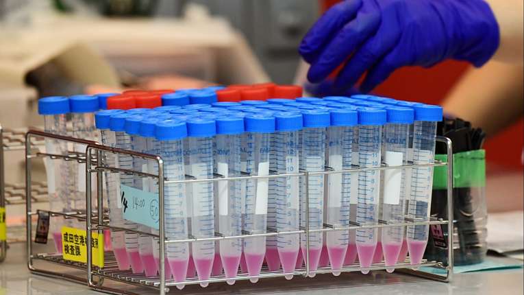 O Japão realizou 65.278 testes PCR em todo o território nacional e registrou 4.312 novas contaminações em um período de 24 horas (relativo ao dia 11 de abril, domingo)