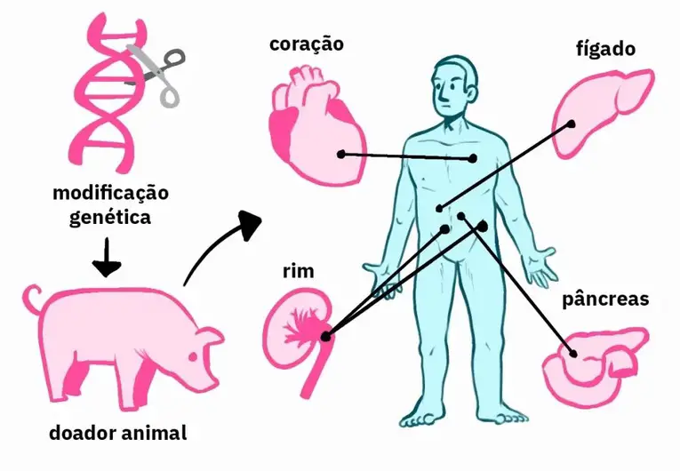 Xenotransplante, técnica com potencial de revolucionar a medicina