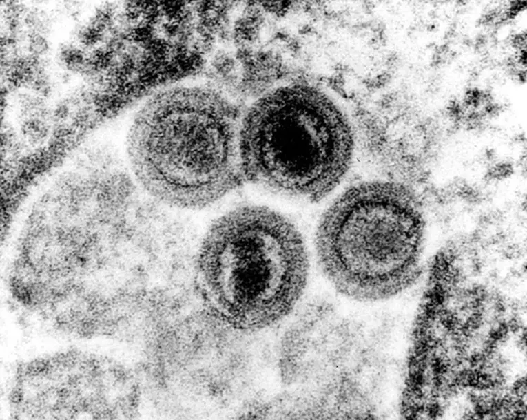 Vírus da herpes tipo 6 (HHV6) visto por microscópio