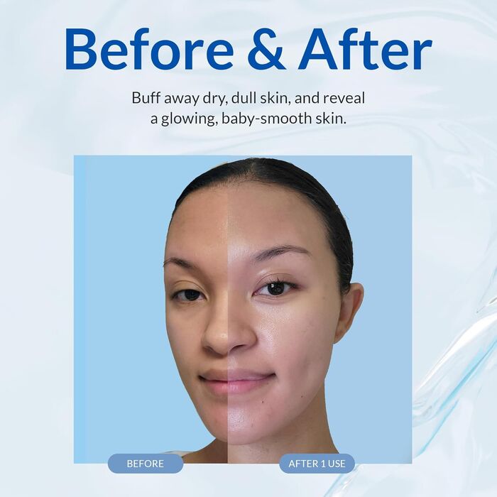 Efeitos do esfoliante em gel Natural Aqua Gel pode ser visto em uma aplicação de 3 minutos