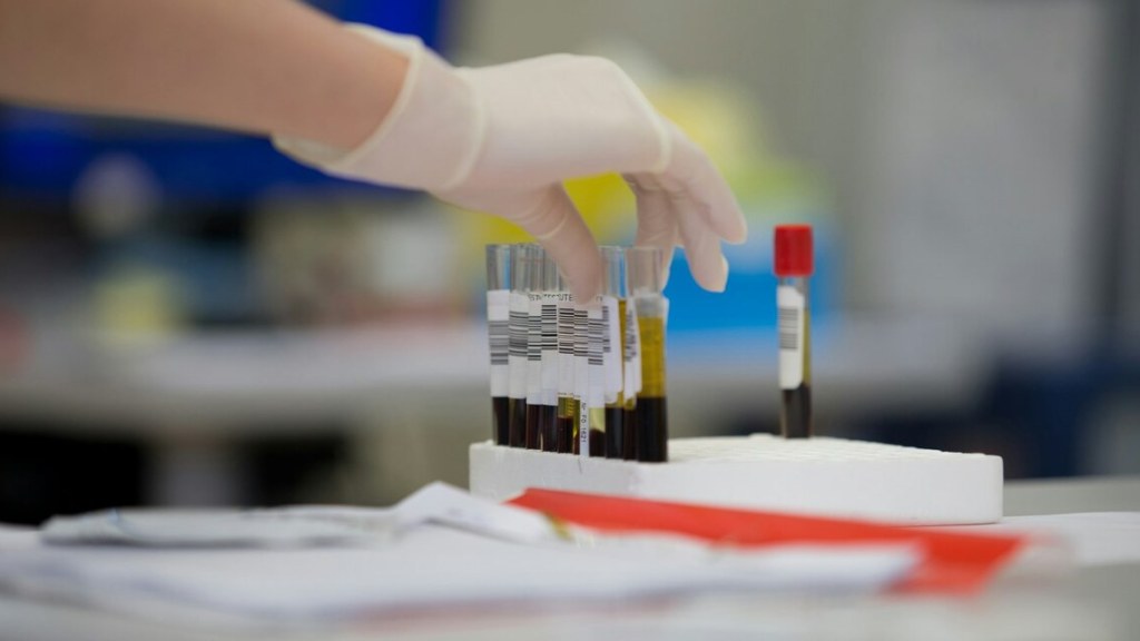 Cientistas japoneses criam sangue artificial compatível com todos os fatores Rh
